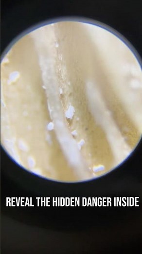 Poisonous mushroom under the microscope!