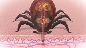 Borreliose - Krankheit mit vielen Gesichtern