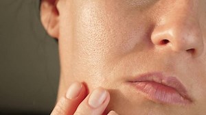 clip-3469749385-problem-skin-dilated-enlarged-pores-close-up-woman
