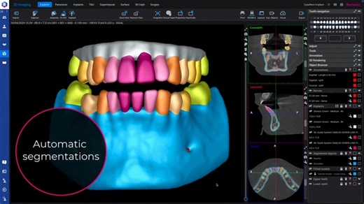 🎓Master Planmeca Romexis® — One Webinar at a Time Join the Planmeca Romexis® Masterclass Webinar Series, launching January 2026, and learn how to confidently use Romexis® dental imaging software—no matter your experience level. Hosted every two weeks by Saila Parmes, Planmeca’s Sales Manager for Software Products, each one-hour session walks through the most practical tools inside Planmeca Romexis—from everyday workflows to advanced applications. Upcoming January Session include: 🗓 Jan 14, 202