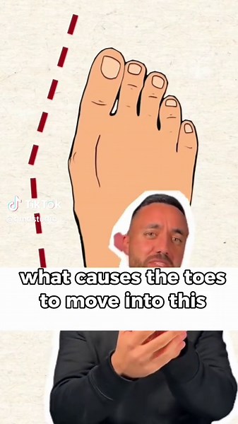 Tips to Stretch Shoes at Home for Better Comfort