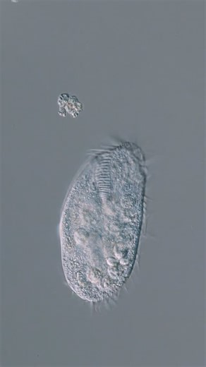 Ariel Waldman on Instagram: "The microcosmos is fun. Ciliate working on its juggling act. Filmed on my Nikon E600 DIC microscope, 20x objective, using my Canon R5C. Found in a sidewalk crack in San Francisco. #microcosmos #microscopy #micro #ciliate #juggling"