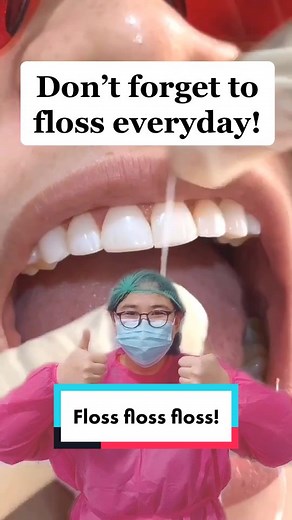 Flossing with Veneers: A Comprehensive Guide