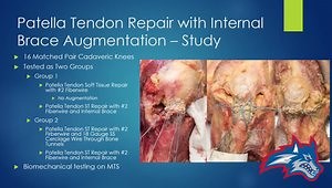 Simplified Techniques for Management of Extensor Mechanism Injuries