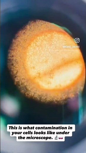 These are BM1 cells (meningioma cell line) showing contamination under the microscope #science