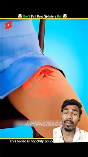 aapko teer lag jaaye to Kya Karen #shortvideo #oppq