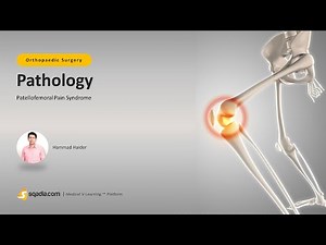 Patellofemoral Pain Syndrome | Pathology