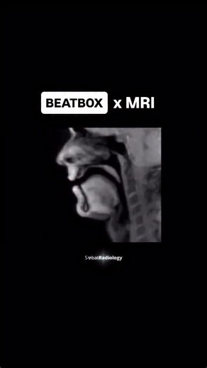 114K views · 4.9K reactions | Good night.. beat boxing inside an MRI Via Sobaf Radiology. @sobatradiology Witness the incredible, high-speed choreography of the human vocal tract in real time. Sound meets science! #mri #radiology #beatbox | Hi-Fructose Magazine | Facebook