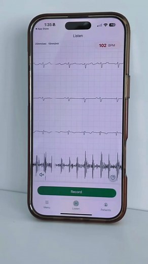 Eko’s digital stethoscope technology provides the clarity and sound amplification you need for effective heart disease detection. 🔊 Up to 40x amplification ❌ Active background noise cancellation 📳 Bluetooth-enabled wireless listening 🎙️ Record, save, visualize, and share sounds with Eko 🚨 Risk-free trial 💲 HSA/FSA eligible | Eko Health