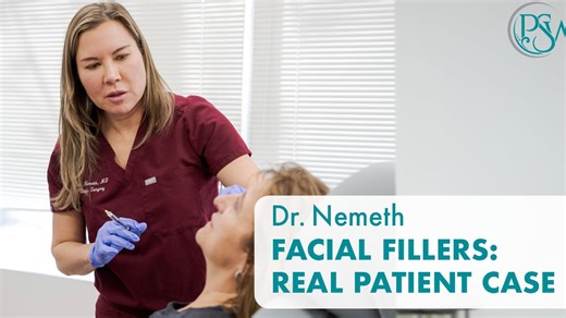 Facial Fillers: Real Patient Case