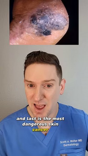 17K views · 267 reactions | How to recognize the three most common types of skin cancer in darker skin complexions: Basal cell carcinoma, squamous cell and melanoma #skincancerawareness #skincancer #melanatedskin #melanoma #basalcellcarcinoma #squamouscellcarcinoma #whatsonmyskin #todayilearned #dermatologist | Scott Walter MD, FAAD | Facebook