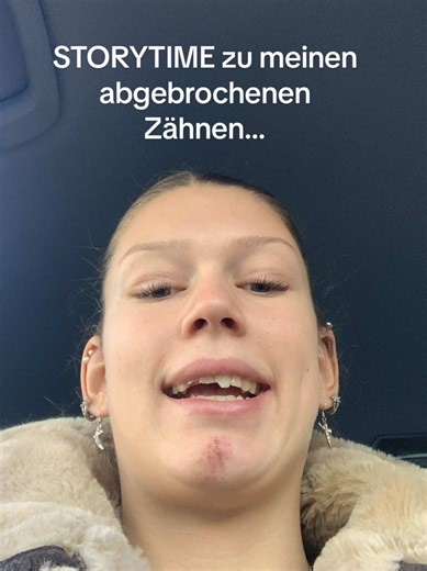 Passt bitte auf eure Zähne auf! #fürdichpage #fürdich #storytime #unfall