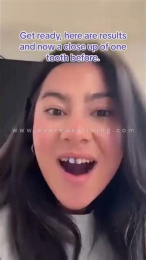 Smile Purple Toothpaste Review 💜 Instant Teeth Whitening?