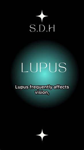 #lupus | Remus Lupin Edit