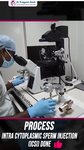 Dr. Pragyan Dash on Instagram: "Intracytoplasmic Sperm Injection (ICSI): A Step That Boosts Fertilisation After the eggs are collected and separated in the IVF lab, Intracytoplasmic Sperm Injection (ICSI) may be used to improve fertilisation chances. In this technique, embryologists carefully select the healthiest sperm by examining its movement and structure under high magnification. The selected sperm is then gently injected directly into the oocyte using fine microscopic instruments. This pre