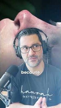 Is General Anesthesia Necessary for Facial Surgery? | IV Sedation Benefits,