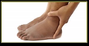 Are Your Legs Swelling Due To The Summer Heat? | CVR Vein