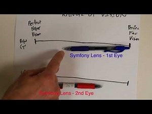 Explaining Range of Vision with the Symfony Lens. Shannon Wong, MD. 6-15-18