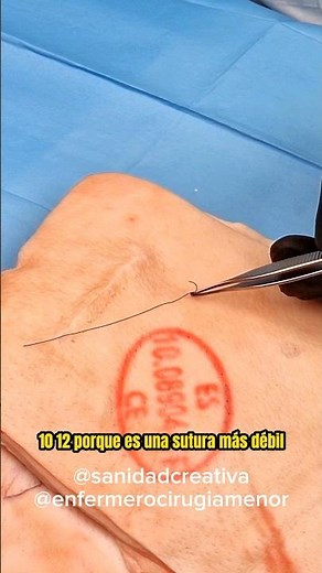 How to remove an intradermal or linear spot