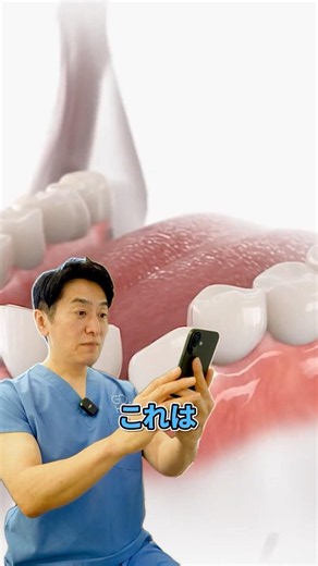 透明なのに動く！マウスピース矯正の仕組み #審美歯科 #歯列矯正 #マウスピース矯正 #インビザライン #歯医者
