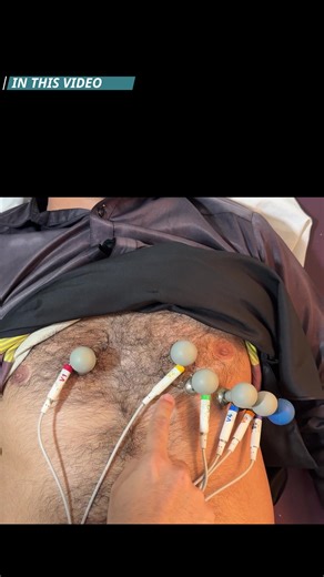 ECG Leads Placement: Step-by-Step Guide for Education