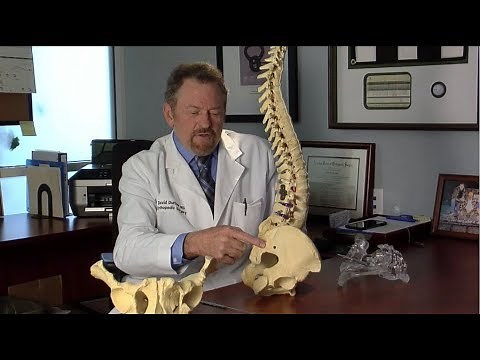 Sacroiliac Joint Fusion with The iFuse Implant - Dr. Duffner