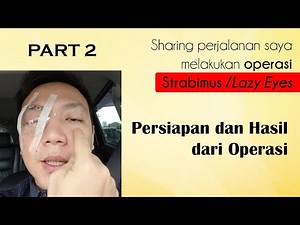 PART 2| Persiapan Operasi dan Hasil dari Operasi Mata Strabismus Lazy eyes atau Mata juling