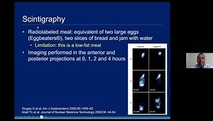 Gastric Emptying Diagnostics: What, When, and Why?
