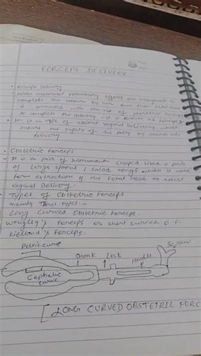 Definition of Forcep delivery#short#nursingstudent#midwifery ...