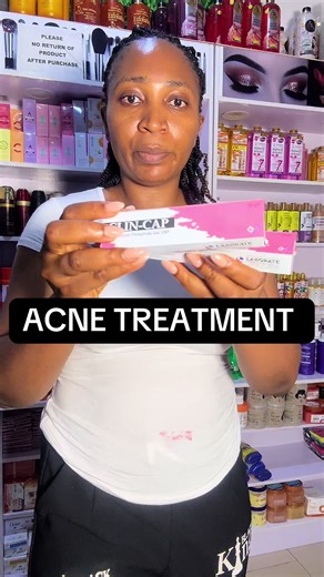 Efectivo tratamiento para el acné con clindamicina