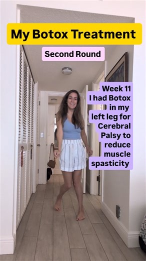 Cayetana Uranga on Instagram: "Botox Check-in! 🧾 It's been almost 3 months since my last Botox treatment for spasticity in my left leg for my Cerebral Palsy, and I can definitely feel it starting to wear off. The good news is that my heel is still making full contact with the floor when I walk-a huge win! However my knees are starting to bump into each other more often. My next session is scheduled in a few weeks, and based on how much it helped me this cycle, I'm absolutely planning on 