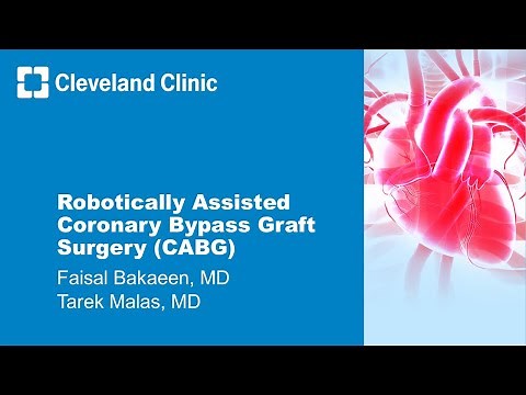 Robotically Assisted Coronary Bypass Graft Surgery (CABG)