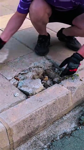 Exploring Common Questions Before a Vasectomy