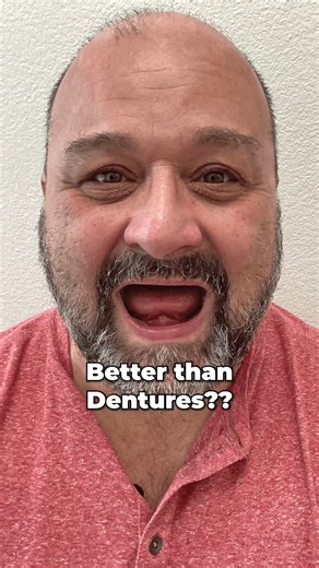 Dentures Vs Permanent Teeth in 24 hours... Which would you choose? 🤔🦷 #Dentures #nuvia #smiletransformation #SmileAgain #DentalImplants | Nuvia Dental Implant Center