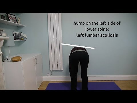 Adams Forward Bend Test