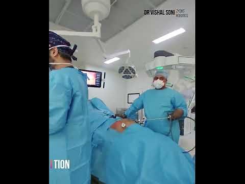 Docking of Surgical Robot Da Vinci Xi