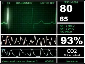 Hospital Monitor (SD)