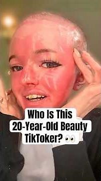 Who Is This 20-Year-Old Beauty TikToker? #shorts #beautytiktoker #ichthyosis