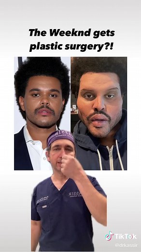 The Weeknd Plastic Surgery: Before and After Transformation