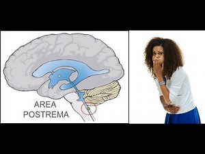 Area Postrema Syndrome (APS)