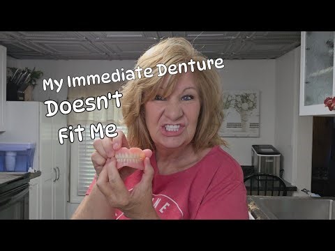 Immediate Denture Too Big