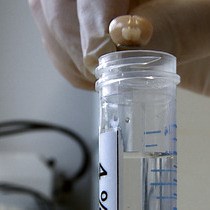 Video: Immunohistochemistry and Multiple Labeling with Antibodies from the Same Host Species to Study Adult Hippocampal Neurogenesis