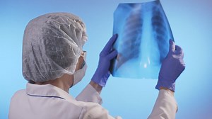Doctor with mask checking a chest x-ray - Free Stock Video