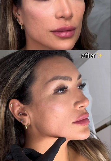 Touché Clinic Results: Real or Fake?