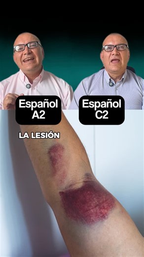 LuisFer | Learn Spanish on Instagram: "Spanish A2 vs C2: “Lesión” in Spanish ✅ Simple vocabulary with clear examples to talk about injuries. #ProfeFer #LearnSpanish #SpanishForBeginners #SpanishTeacher #EspañolA2 #EspañolC2 #SpanishVocabulary #SpanishTips"