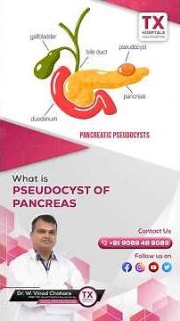 What is Pseudocyst of Pancreas? | Dr. W. Vinod Chahare || TX Hospitals