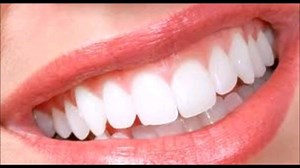 Subliminal: Perfect teeth and healthy Gums