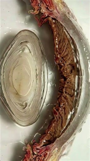 The art of eye reconstruction from real histology to a generated eye with cataract and IOL.#shorts