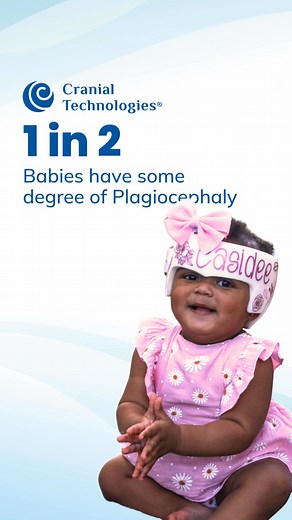 The DOC Band® is 32% lighter than other products. Find out how Cranial Technologies can help your baby today. | Cranial Technologies