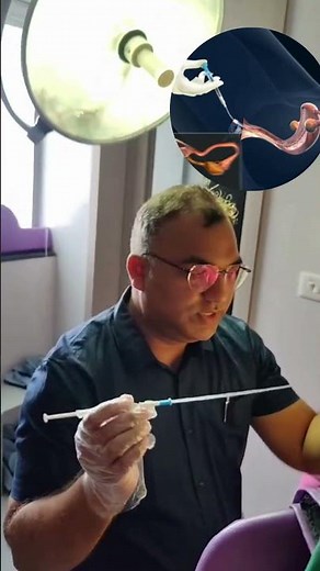 🌟 Understanding the IUI Procedure 🌟